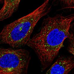 gamma Adaptin Polyclonal Antibody, Invitrogen 100 &mu;L | Buy Online | Thermo Scientific | Fisher Scientific