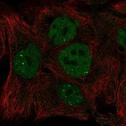 Invitrogen INO80 Polyclonal Antibody 100 &mu;L | Buy Online | Invitrogen&trade; | Fisher Scientific