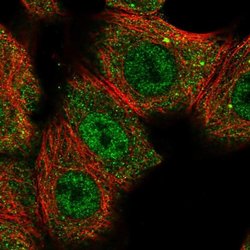 CNOT10 Polyclonal Antibody:Antibodies, Polyclonal