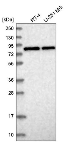 CNOT10 Polyclonal Antibody:Antibodies, Polyclonal