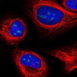 Invitrogen UTP3 Polyclonal Antibody 100 &mu;L; Unconjugated:Antibodies,
