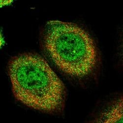 Invitrogen PEPP2 Polyclonal Antibody 100 &mu;L; Unconjugated:Antibodies,