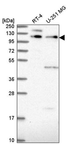 Invitrogen PEPP2 Polyclonal Antibody 100 &mu;L; Unconjugated:Antibodies,