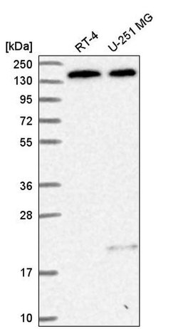 Invitrogen DHX38 Polyclonal Antibody 100 &mu;L; Unconjugated:Antibodies,