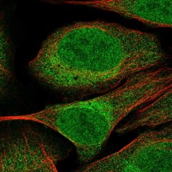Invitrogen CUEDC2 Polyclonal Antibody 100 &mu;L; Unconjugated:Antibodies,
