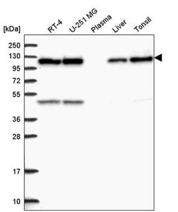 Invitrogen C15orf39 Polyclonal Antibody 100 &mu;L; Unconjugated:Antibodies,