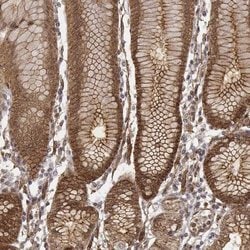 Invitrogen ZFYVE19 Polyclonal Antibody 100 &mu;L | Buy Online | Invitrogen&trade; | Fisher Scientific