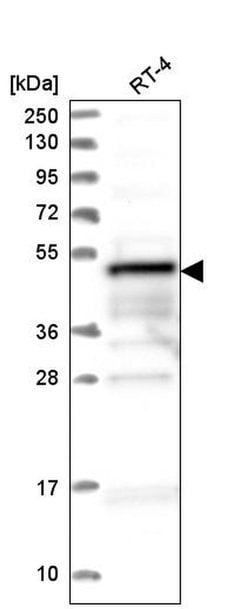 Invitrogen ZFYVE19 Polyclonal Antibody 100 &mu;L | Buy Online | Invitrogen&trade; | Fisher Scientific