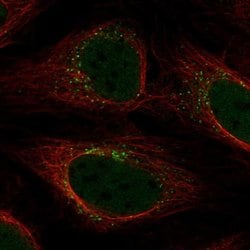 Invitrogen YIPF5 Polyclonal Antibody 100 &mu;L; Unconjugated:Antibodies,