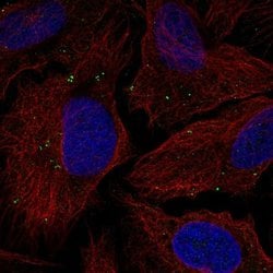 Invitrogen TMEM198 Polyclonal Antibody 100 &mu;L; Unconjugated:Antibodies,