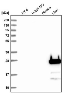 Invitrogen FGF5 Polyclonal Antibody 100 &mu;L | Buy Online | Invitrogen&trade; | Fisher Scientific