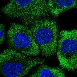 Invitrogen RNF207 Polyclonal Antibody 100 &mu;L; Unconjugated:Antibodies,