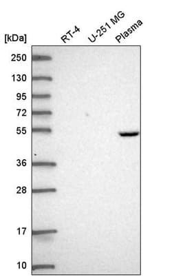 Invitrogen PDSS1 Polyclonal Antibody 100 &mu;L; Unconjugated:Antibodies,
