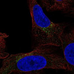 Invitrogen FUT7 Polyclonal Antibody 100 &mu;L | Buy Online | Invitrogen&trade; | Fisher Scientific