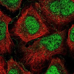 Invitrogen GPCPD1 Polyclonal Antibody 100 &mu;L; Unconjugated:Antibodies,