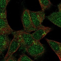 Invitrogen FKRP Polyclonal Antibody 100 &mu;L; Unconjugated:Antibodies,