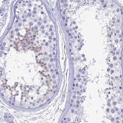 Invitrogen GNGT2 Polyclonal Antibody 100 &mu;L; Unconjugated:Antibodies,