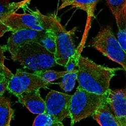 LPHN2 Polyclonal Antibody, Invitrogen 100 &mu;L; Unconjugated:Antibodies,