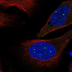 Invitrogen EVI5L Polyclonal Antibody 100 &mu;L; Unconjugated:Antibodies,