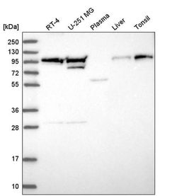 Invitrogen EVI5L Polyclonal Antibody 100 &mu;L; Unconjugated:Antibodies,