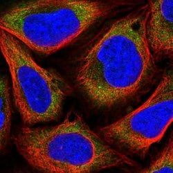 Invitrogen MAGED1 Polyclonal Antibody 100 &mu;L; Unconjugated:Antibodies,