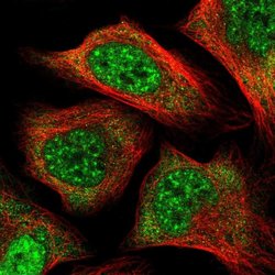 Invitrogen PCBP1 Polyclonal Antibody 100 &mu;L; Unconjugated:Antibodies,