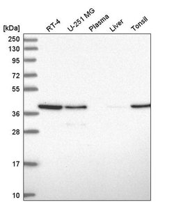 Invitrogen PCBP1 Polyclonal Antibody 100 &mu;L; Unconjugated:Antibodies,