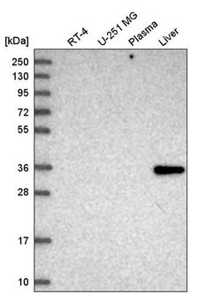 Invitrogen GLYAT Polyclonal Antibody 100 &mu;L; Unconjugated:Antibodies,