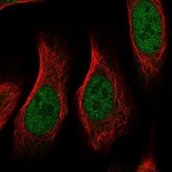 Invitrogen RGMA Polyclonal Antibody 100 &mu;L; Unconjugated:Antibodies,