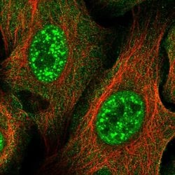 Invitrogen ZNF337 Polyclonal Antibody 100 &mu;L; Unconjugated:Antibodies,