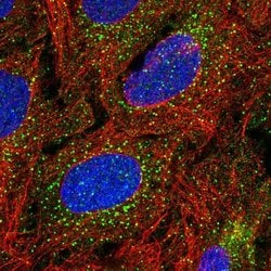 Invitrogen TBX4 Polyclonal Antibody 100 &mu;L; Unconjugated:Antibodies,