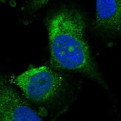 Invitrogen UTP15 Polyclonal Antibody 100 &mu;L; Unconjugated:Antibodies,