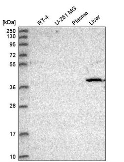 CDK8 Polyclonal Antibody 100 &mu;L | Buy Online | Thermo Scientific | Fisher Scientific