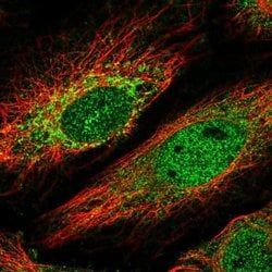 Invitrogen HKR1 Polyclonal Antibody 100 &mu;L; Unconjugated:Antibodies,
