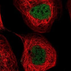 NUDT2 Polyclonal Antibody:Antibodies, Polyclonal