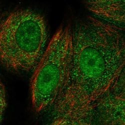 Invitrogen RAD51C Polyclonal Antibody 100 &mu;L; Unconjugated:Antibodies,