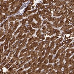 Invitrogen Growth Hormone Receptor Polyclonal Antibody 100 &mu;L; Unconjugated:Antibodies,