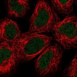Invitrogen ALKBH2 Polyclonal Antibody 100 &mu;L; Unconjugated:Antibodies,