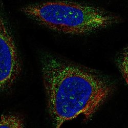 Invitrogen TMEM212 Polyclonal Antibody 100 &mu;L; Unconjugated:Antibodies,