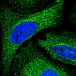 Invitrogen ADAL Polyclonal Antibody 100 &mu;L; Unconjugated:Antibodies,
