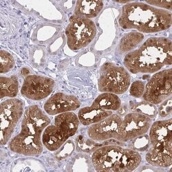 Invitrogen GLRX Polyclonal Antibody 100 &mu;L | Buy Online | Invitrogen&trade; | Fisher Scientific