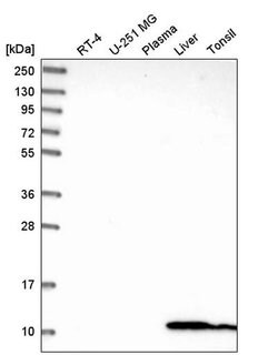 Invitrogen GLRX Polyclonal Antibody 100 &mu;L | Buy Online | Invitrogen&trade; | Fisher Scientific