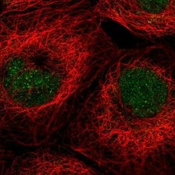 Invitrogen ALKBH3 Polyclonal Antibody 100 &mu;L; Unconjugated:Antibodies,
