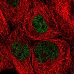 Invitrogen ZHX3 Polyclonal Antibody 100 &mu;L; Unconjugated:Antibodies,