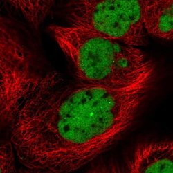 RDBP Polyclonal Antibody:Antibodies, Polyclonal