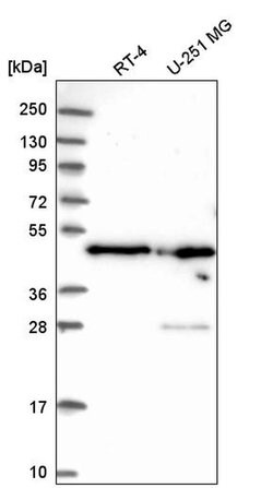 RDBP Polyclonal Antibody:Antibodies, Polyclonal