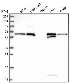 Invitrogen RETSAT Polyclonal Antibody 100 &mu;L; Unconjugated:Antibodies,
