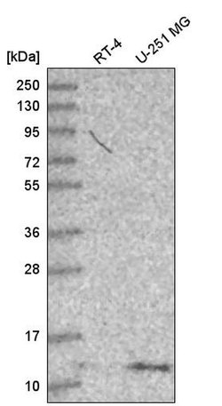 Invitrogen DYNLT1 Polyclonal Antibody 100 &mu;L | Buy Online | Invitrogen&trade; | Fisher Scientific