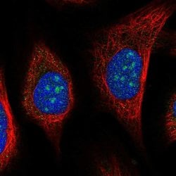 Invitrogen URB2 Polyclonal Antibody 100 &mu;L; Unconjugated:Antibodies,