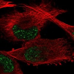 Invitrogen GTF2H2 Polyclonal Antibody 100 &mu;L; Unconjugated:Antibodies,
